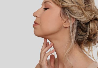 juvederm-hilton-head-img1-2